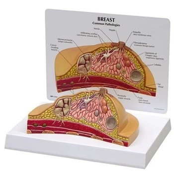 žmogaus anatomijos modelis krūties patologijos modelis modelis